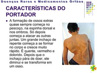 CARACTERÍSTICAS DO
PORTADOR
   A formação de ossos extras
    quase sempre começa no
    pescoço, na espinha dorsal e
    nos ombros. Só depois
    começa a atacar as outras
    juntas. Um grande inchaço de
    repente começa a se formar
    no corpo e cresce muito
    rápido. É quente, vermelho e
    dolorido. Depois que o
    inchaço pára de doer, ele
    diminui e se transforma em
    um osso.
 