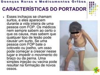 CARACTERÍSTICAS DO PORTADOR
 Esses inchaços se chamam
 surtos, e eles aparecem
 durante a vida inteira de uma
 pessoa com FOP. Os médicos
 nem sempre sabem ao certo o
 que os causa, mas sabem que
 qualquer tipo de lesão pode
 causar um surto. Se uma
 pessoa com FOP bate o
 cotovelo ou joelho, um osso
 pode começar a crescer nesse
 lugar e impedir o movimento do
 braço ou da perna. Uma
 simples injeção ou vacina pode
 resultar na formação de novos
 ossos.
 