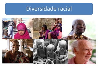 Diversidade racial
 