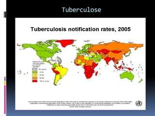 Tuberculose
 
