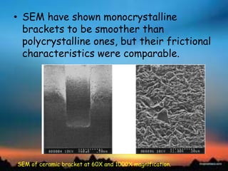 • SEM have shown monocrystalline
brackets to be smoother than
polycrystalline ones, but their frictional
characteristics were comparable.
SEM of ceramic bracket at 60X and 1000X magnification.
 