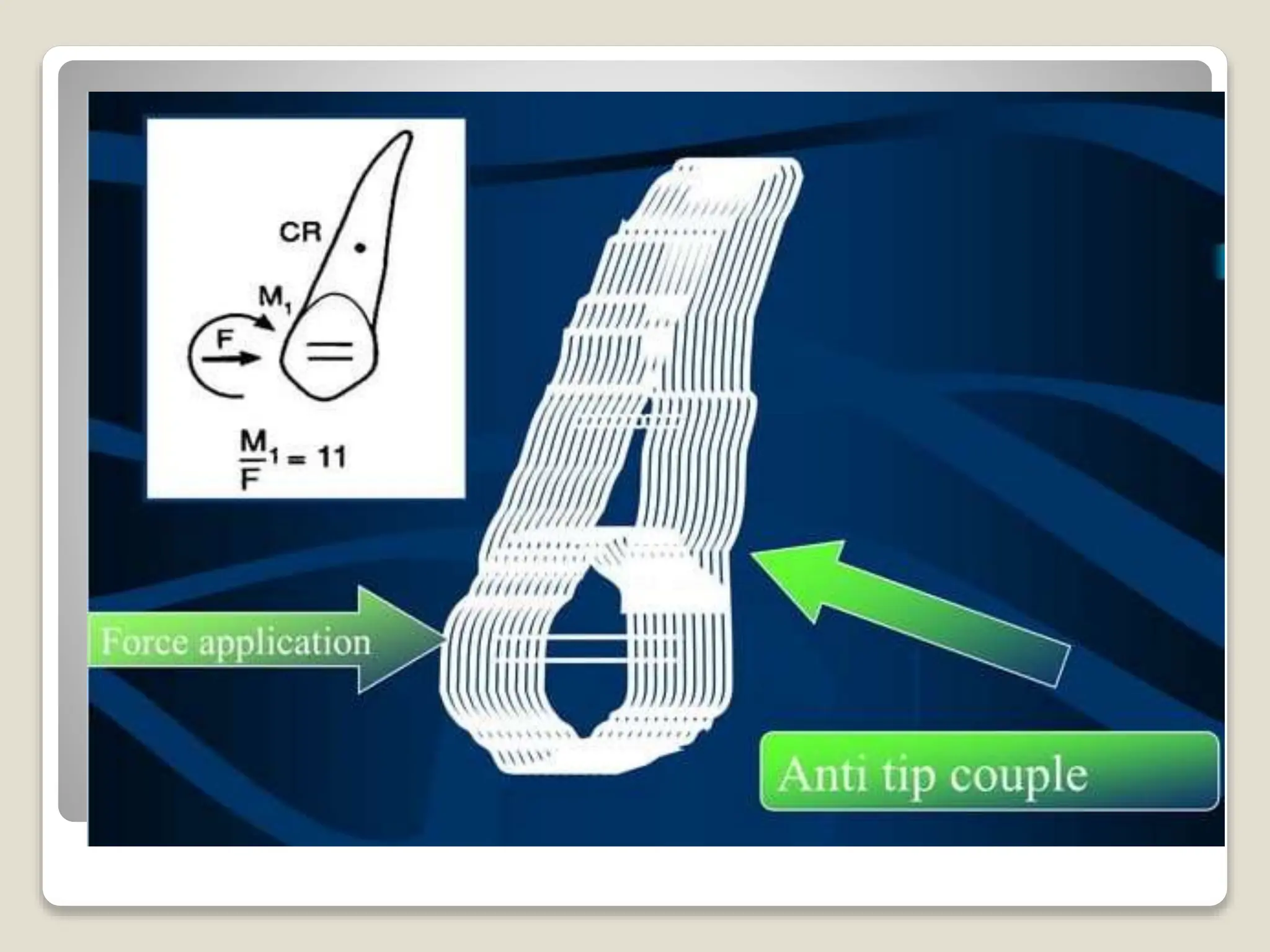 Snapshot of Adjustable Closure With Frictionless Movement