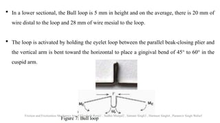 Friction Loop Friction v/s frictionless mechanics orthodontics | PPTX