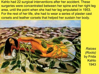 Raices
(Roots)
by Frida
Kahlo
1943
Kahlo had 22 surgical interventions after her accident. These
surgeries were concentrated between her spine and her right leg
area, until the point when she had her leg amputated in 1953.
For the rest of her life, she had to wear a series of plaster cast
corsets and leather corsets that helped her sustain her body.
 