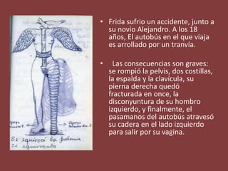 • Frida sufrio un accidente, junto a
su novio Alejandro. A los 18
años, El autobús en el que viaja
es arrollado por un tranvía.
• Las consecuencias son graves:
se rompió la pelvis, dos costillas,
la espalda y la clavícula, su
pierna derecha quedó
fracturada en once, la
disconyuntura de su hombro
izquierdo, y finalmente, el
pasamanos del autobús atravesó
su cadera en el lado izquierdo
para salir por su vagina.
 