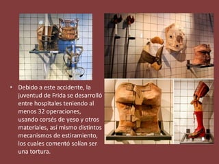 • Debido a este accidente, la
juventud de Frida se desarrolló
entre hospitales teniendo al
menos 32 operaciones,
usando corsés de yeso y otros
materiales, así mismo distintos
mecanismos de estiramiento,
los cuales comentó solían ser
una tortura.
 