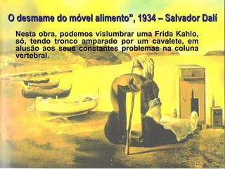 O desmame do móvel alimento”, 1934 – Salvador DalíO desmame do móvel alimento”, 1934 – Salvador Dalí
Nesta obra, podemos vislumbrar uma Frida Kahlo,
só, tendo tronco amparado por um cavalete, em
alusão aos seus constantes problemas na coluna
vertebral.
 