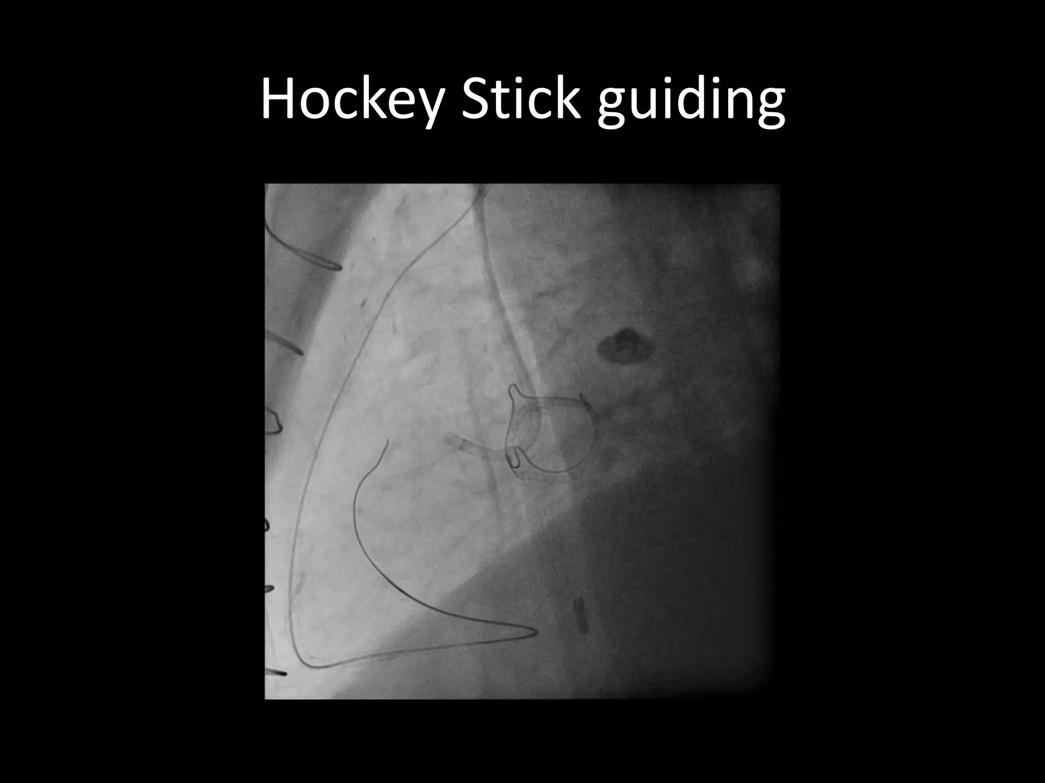 Hockey Stick guiding