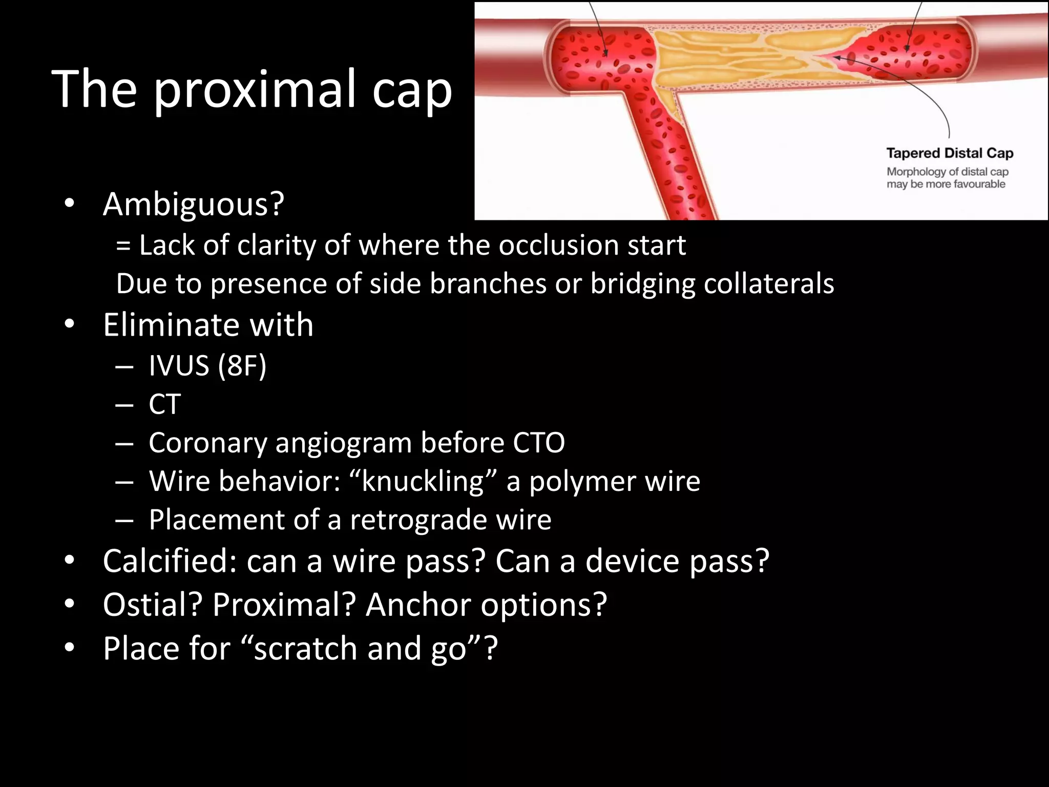 The proximal cap
• Ambiguous?
= Lack of clarity of where the occlusion start
Due to presence of side branches or bridging collaterals
• Eliminate with
– IVUS (8F)
– CT
– Coronary angiogram before CTO
– Wire behavior: “knuckling” a polymer wire
– Placement of a retrograde wire
• Calcified: can a wire pass? Can a device pass?
• Ostial? Proximal? Anchor options?
• Place for “scratch and go”?