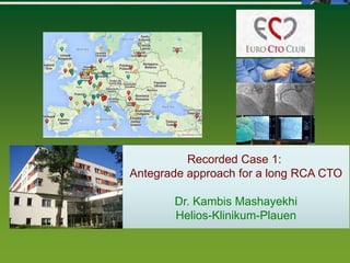 0
Recorded Case 1:
Antegrade approach for a long RCA CTO
Dr. Kambis Mashayekhi
Helios-Klinikum-Plauen
 
