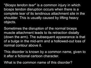 "Biceps tendon tear" is a common injury in which
biceps tendon disruption occurs when there is a
complete tear of its tendinous attachment site in the
shoulder. This is usually caused by lifting heavy
objects.
Sometimes the disruption of the normal biceps
muscle attachment leads to its retraction distally
(down the arm). The subsequent appearance is that
of a bulge in the mid-arm and a hollowed-out loss of
normal contour above it.
This disorder is known by a common name, given to
it after a fictional cartoon character.
What is the common name of this disorder?
 