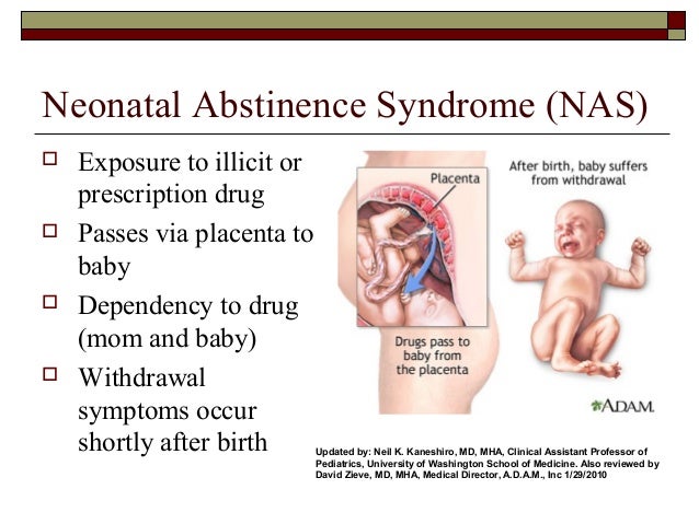 codeine withdrawal symptoms newborns