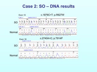 Case 2: SO – DNA results
SO
Normal
SO
Normal
c.2740A>C; p.T914P
c.1879C>T; p.R627WExon 10
Exon 18
 