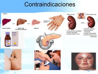 Contraindicaciones

Page 11

 