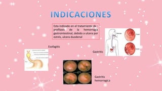 Esta indicado en el tratamiento de :
profilaxis de la hemorragia
gastrointestinal, debido a ulcera por
estrés, ulcera duodenal
Gastritis
Esofagitis
Gastritis
hemorragica
 