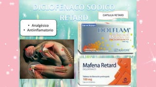 CAPSULA RETARD
• Analgésico
• Antiinflamatorio
 