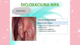 INDICACIONES:
ESPECTRO ANTIMICROBIANO
Bacterias Gram Positivas
• Staphylococcus productor o no de
betalactamasa
• Streptococcus pyogenes
• Streptococcus pneumoniae
 