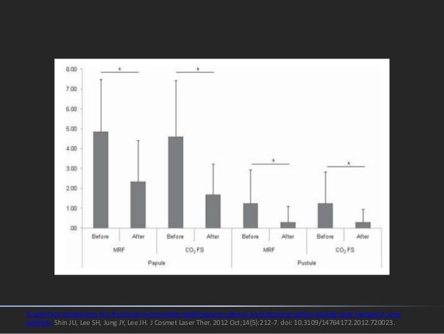Fractional Radiofrequency Microneedling In Esthetic Medicine