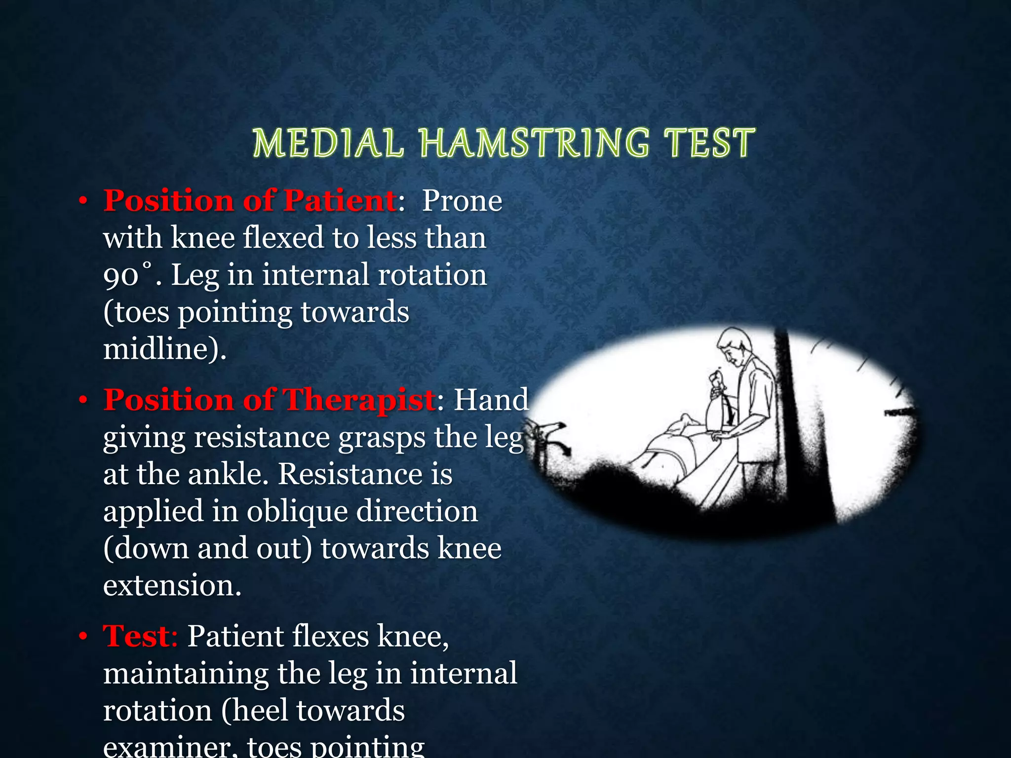 • Position of Patient: Prone
with knee flexed to less than
90˚. Leg in internal rotation
(toes pointing towards
midline).
• Position of Therapist: Hand
giving resistance grasps the leg
at the ankle. Resistance is
applied in oblique direction
(down and out) towards knee
extension.
• Test: Patient flexes knee,
maintaining the leg in internal
rotation (heel towards
examiner, toes pointing
 