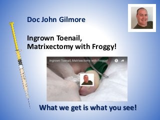 Ingrown Toenail,
Matrixectomy with Froggy!
What we get is what you see!
Doc John Gilmore
 