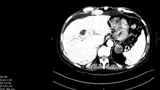 CT scan introduction for surgical residents | PPTX | Medical Tests ...