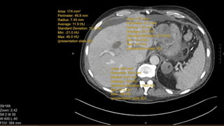 CT scan introduction for surgical residents | PPTX | Medical Tests ...