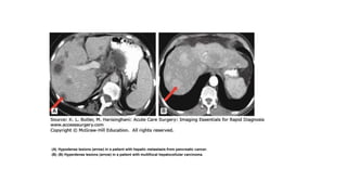 CT scan introduction for surgical residents | PPTX | Medical Tests ...