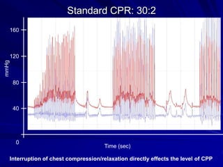 5 sec
80
160
mmHg
Time (sec)
40
120
0
Standard CPR: 30:2
Interruption of chest compression/relaxation directly effects the level of CPP
 