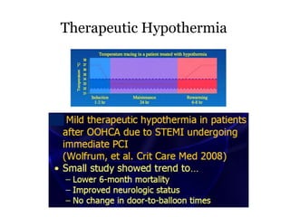 Therapeutic Hypothermia
 