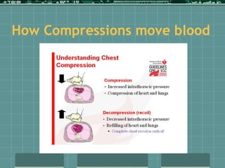How Compressions move blood
 