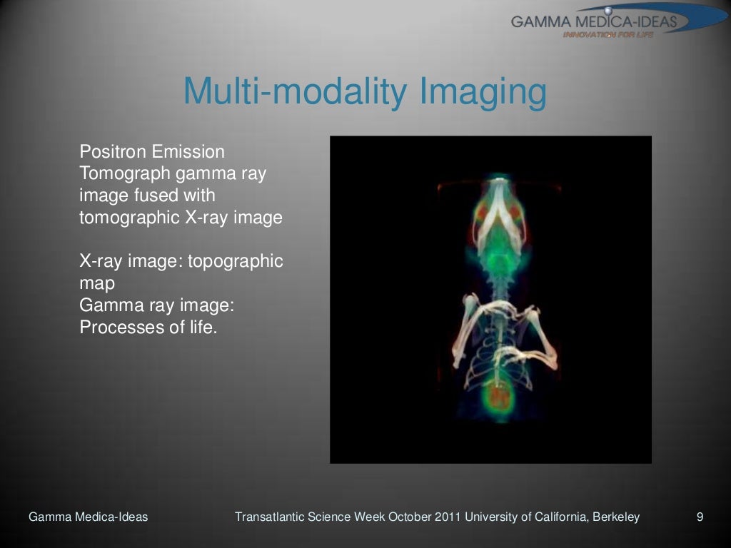From gamma ray imaging in space to medical diagnostics