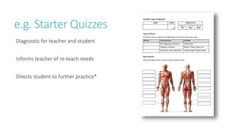 e.g. Starter Quizzes
Diagnostic for teacher and student
Informs teacher of re-teach needs
Directs student to further practice*
 