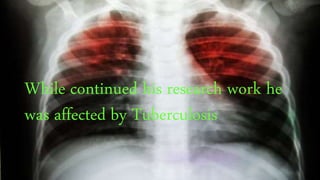 While continued his research work he
was affected by Tuberculosis
 