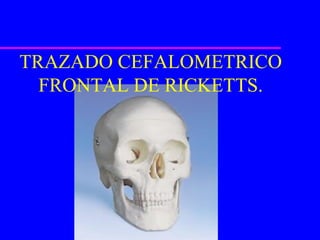 TRAZADO CEFALOMETRICO
  FRONTAL DE RICKETTS.
 