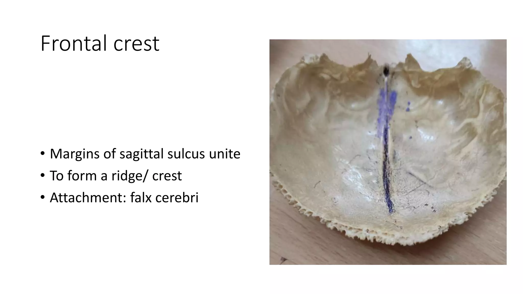Frontal crest
• Margins of sagittal sulcus unite
• To form a ridge/ crest
• Attachment: falx cerebri
 