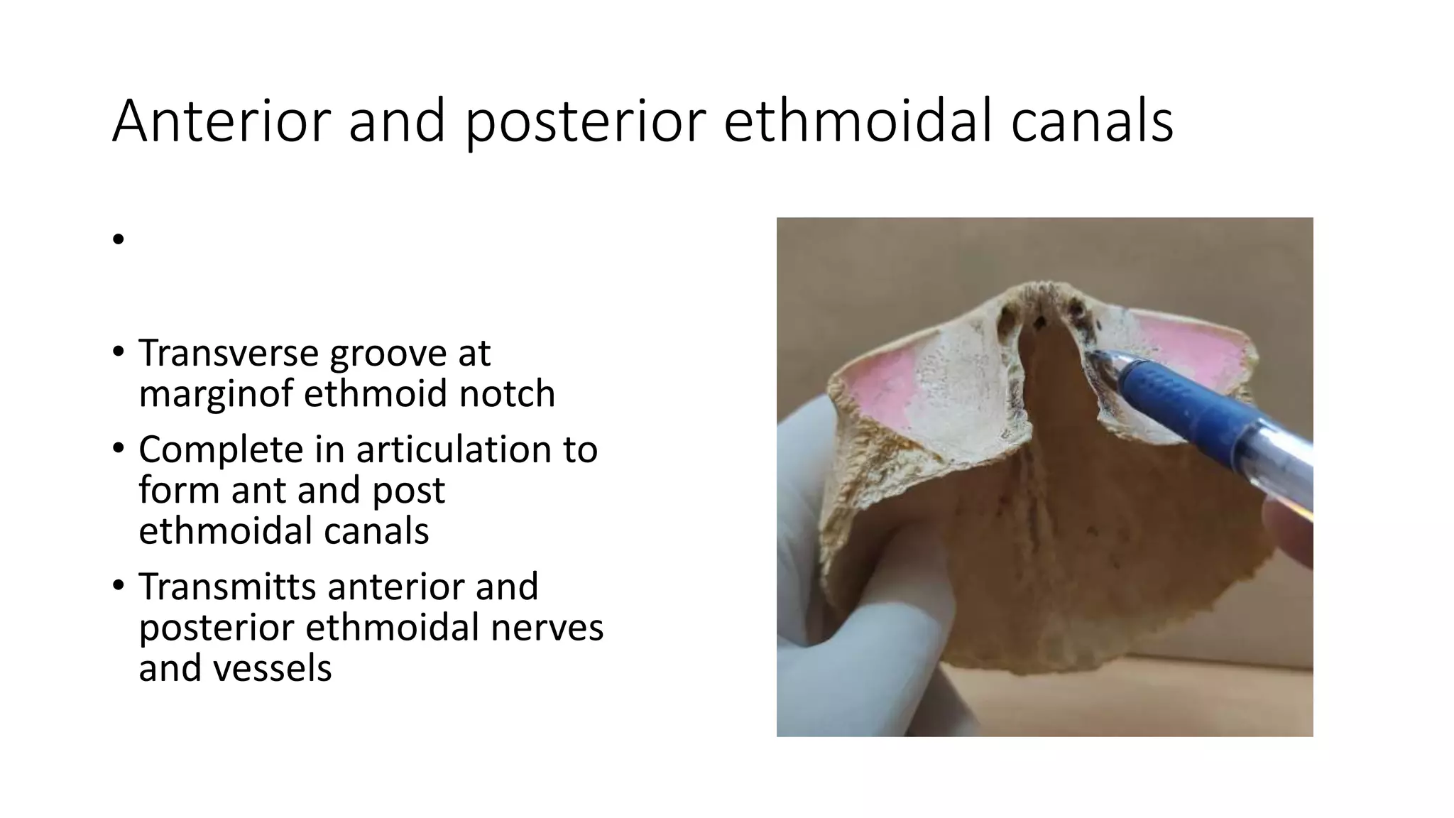 Anterior and posterior ethmoidal canals
•
• Transverse groove at
marginof ethmoid notch
• Complete in articulation to
form ant and post
ethmoidal canals
• Transmitts anterior and
posterior ethmoidal nerves
and vessels
 