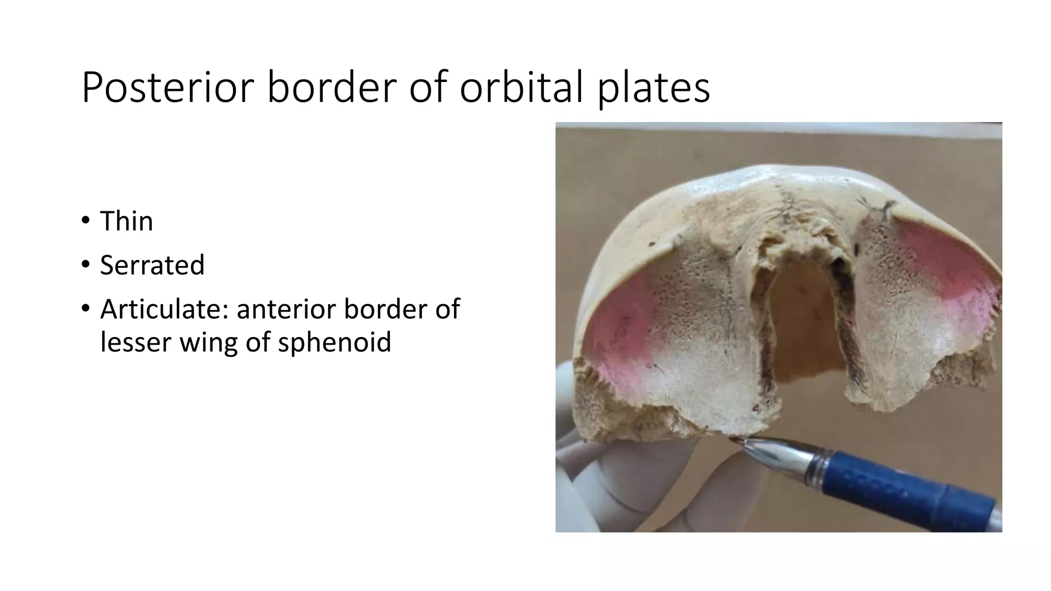 Posterior border of orbital plates
• Thin
• Serrated
• Articulate: anterior border of
lesser wing of sphenoid
 