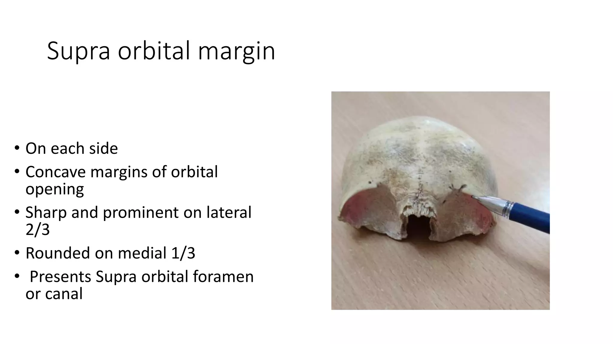 Supra orbital margin
• On each side
• Concave margins of orbital
opening
• Sharp and prominent on lateral
2/3
• Rounded on medial 1/3
• Presents Supra orbital foramen
or canal
 