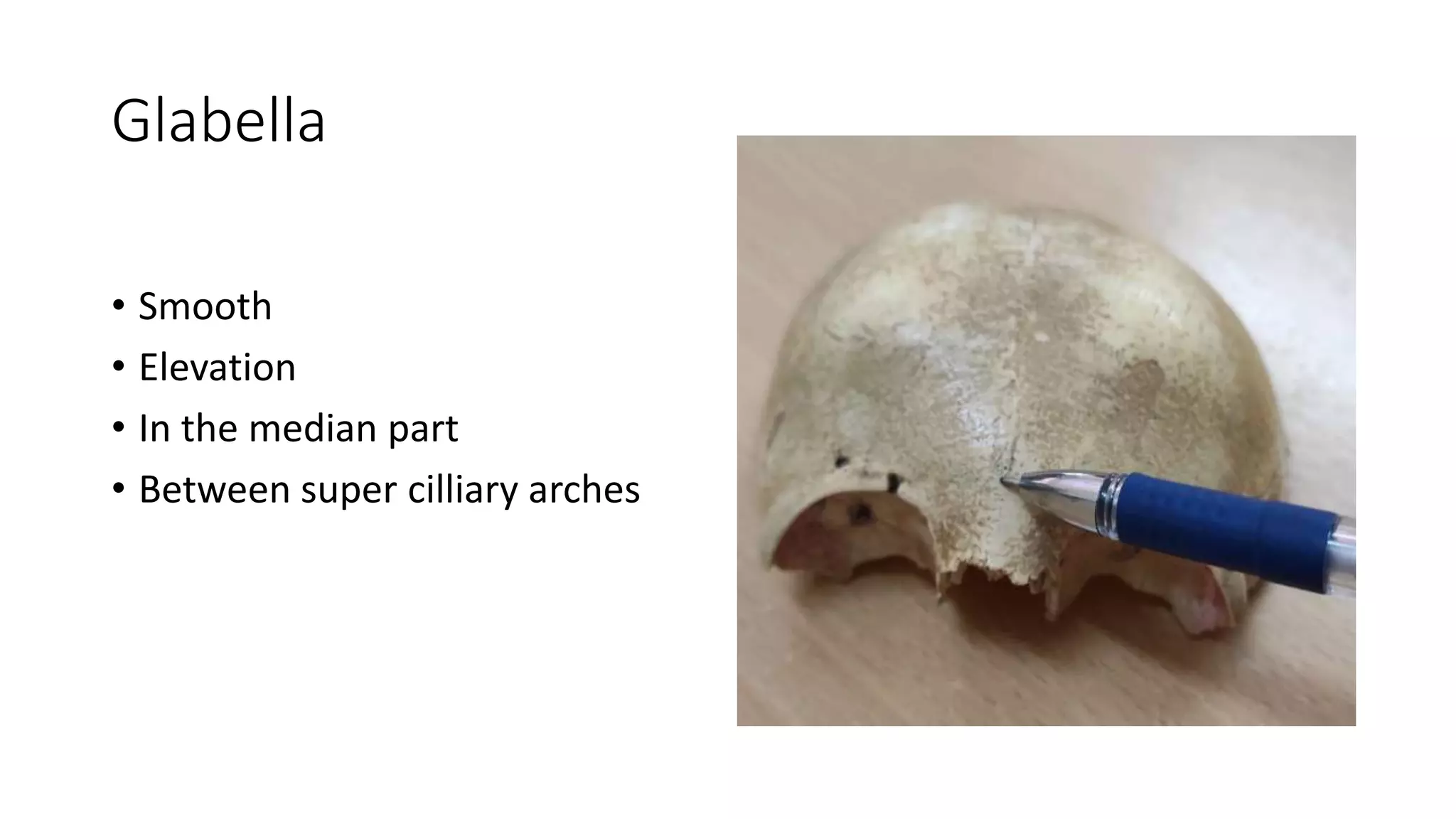Glabella
• Smooth
• Elevation
• In the median part
• Between super cilliary arches
 