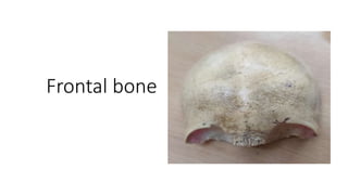 Frontal bone
 