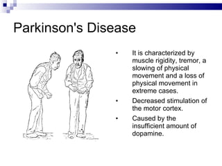 Parkinson's Disease It is characterized by muscle rigidity, tremor, a slowing of physical movement and a loss of physical movement in extreme cases. Decreased stimulation of the motor cortex. Caused by the insufficient amount of dopamine. 