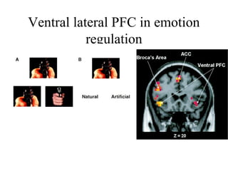 Ventral lateral PFC in emotion
regulation
 