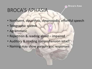 BROCA’S APHASIA
• Nonfluent, dysarthric, dysprosodic, effortful speech
• Telegraphic speech
• Agrammatic
• Repetition & reading aloud – impaired
• Auditory & reading comprehension intact
• Naming may show paraphrasic responses
 