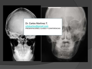Dr. Carlos Martínez T.ortokarlos@gmail.comPRESENTACIONES, CLASES Y CONFERENCIAS.