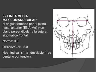 2.- LINEA MEDIA MAXILOMANDIBULAR:             el ángulo formado por el plano nasal anterior (ENA-Me) y un plano perpendicular a la sutura zigomático frontal.Norma: 0.0°DESVIACIóN: 2.0°Nosindicasí la desviaciónes dental o porfunción.