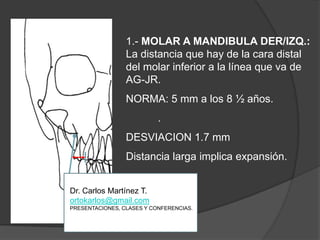 1.- MOLAR A MANDIBULA DER/IZQ.:                                        La distancia que hay de la cara distal del molar inferior a la línea que va de AG-JR.NORMA: 5 mm a los 8 ½ años..DESVIACION 1.7 mmDistancialargaimplicaexpansión.Dr. Carlos Martínez T.ortokarlos@gmail.comPRESENTACIONES, CLASES Y CONFERENCIAS.