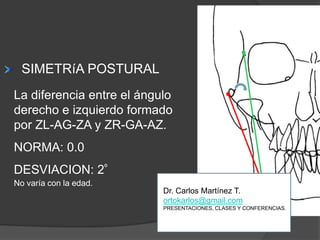 SIMETRíAPOSTURALLa diferencia entre el ángulo derecho e izquierdo formado por ZL-AG-ZA y ZR-GA-AZ.NORMA: 0.0DESVIACION: 2ºNo varía con la edad.Dr. Carlos Martínez T.ortokarlos@gmail.comPRESENTACIONES, CLASES Y CONFERENCIAS.
