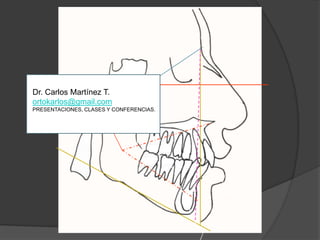 Dr. Carlos Martínez T.ortokarlos@gmail.comPRESENTACIONES, CLASES Y CONFERENCIAS.