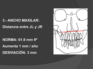3.- ANCHO MAXILAR:Distancia entre JL y JRNORMA: 61.9 mm 9ªAumenta 1 mm / añoDESVIACIÓN: 3 mm