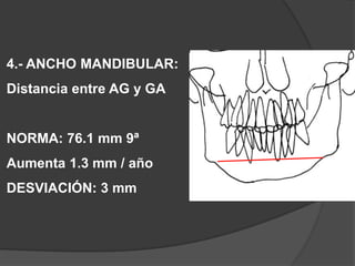 4.- ANCHO MANDIBULAR:Distancia entre AG y GANORMA: 76.1 mm 9ªAumenta 1.3 mm / añoDESVIACIÓN: 3 mm